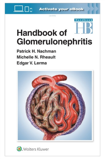 Handbook Glomerulonephritis by Andy Lee Andy - Paperback