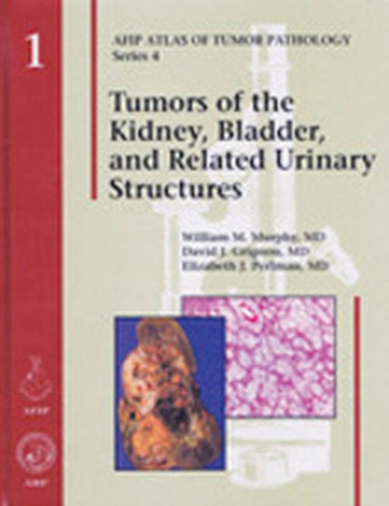 Tumors of the Kidney, Bladder, and Related Urinary Structures by William M. Murphy - Hardback