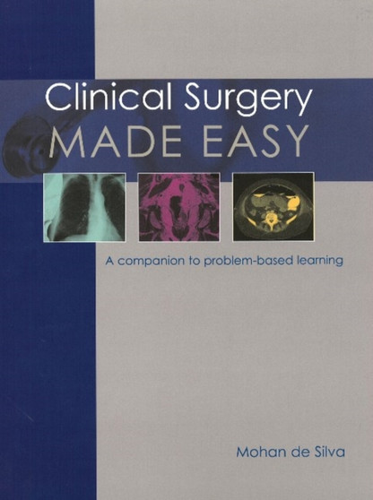Clinical Surgery Made Easy : A companion to problem-based learning by Professor Mohan de Silva - Paperback