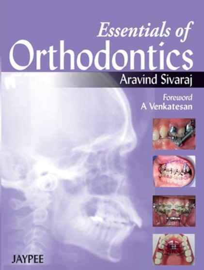 Essentials of Orthodontics by Aravind Sivaraj - Paperback