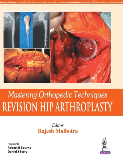Mastering Orthopedic Techniques: Revision Total Hip Arthroplasty by Rajesh Malhotra - Hardback