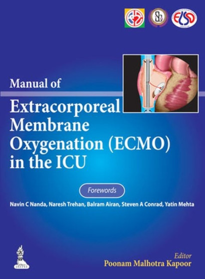 Manual of Extracorporeal Membrane Oxygenation (ECMO) in the ICU by Poonam Malhotra Kapoor - Hardback
