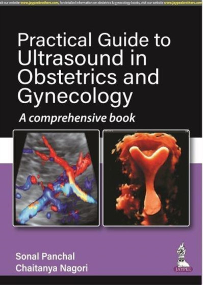 Practical Guide to Ultrasound in Obstetrics and Gynecology : A Comprehensive Book by Sonal Panchal - Paperback