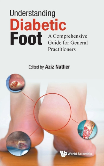 Understanding Diabetic Foot: A Comprehensive Guide For General Practitioners by Abdul Aziz Nather - Hardback