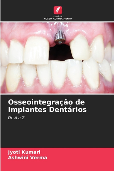 Osseointegracao de Implantes Dentarios by Jyoti Kumari - Paperback