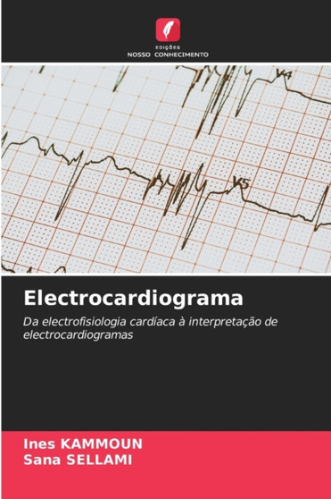 Electrocardiograma by Ines Kammoun - Paperback