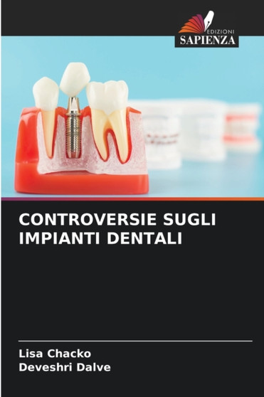 Controversie Sugli Impianti Dentali by Lisa Chacko - Paperback