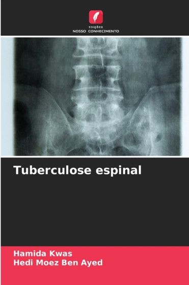 Tuberculose espinal by Hamida Kwas - Paperback