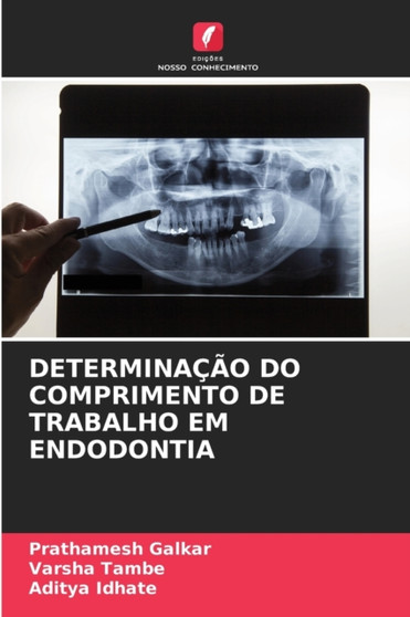 Determinacao Do Comprimento de Trabalho Em Endodontia by Prathamesh Galkar - Paperback