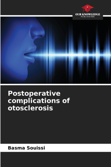 Postoperative complications of otosclerosis by Basma Souissi - Paperback