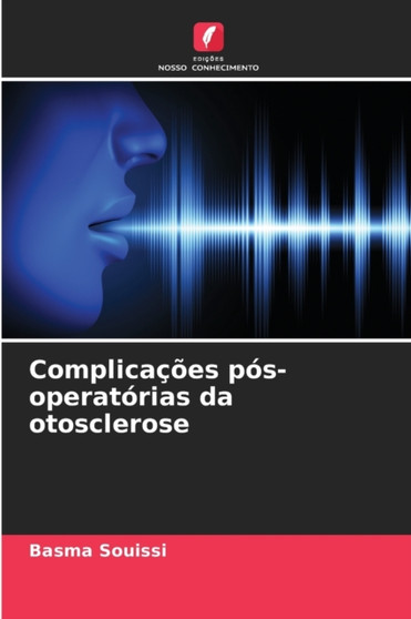 Complicacoes pos-operatorias da otosclerose by Basma Souissi - Paperback