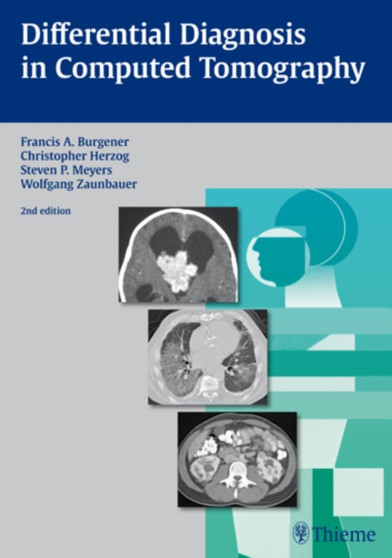 Differential Diagnosis in Computed Tomography by Francis A. Burgener - Hardback