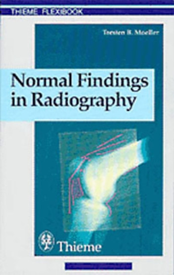 Normal Findings in Radiography by Torsten Bert Moeller - Paperback