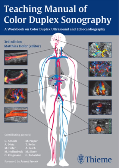 Teaching Manual of Color Duplex Sonography by Matthias Hofer - Paperback