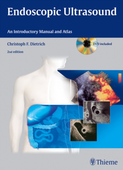 Endoscopic Ultrasound : An Introductory Manual and Atlas by Christoph Frank Dietrich - Hardback