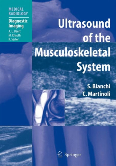 Ultrasound of the Musculoskeletal System by Stefano Bianchi - Hardback