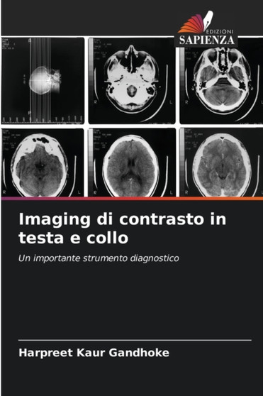Imaging di contrasto in testa e collo by Harpreet Kaur Gandhoke - Paperback