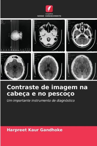 Contraste de imagem na cabeca e no pescoco by Harpreet Kaur Gandhoke - Paperback
