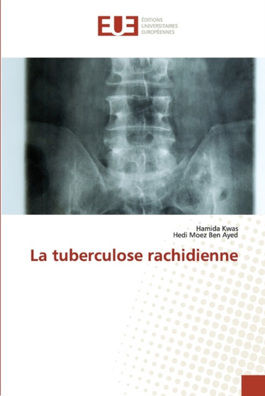La tuberculose rachidienne by Hamida Kwas - Paperback