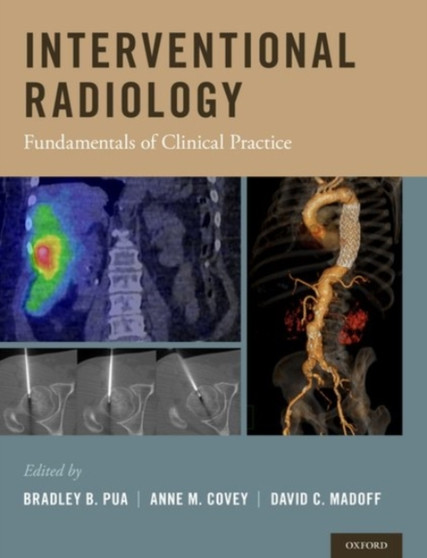 Interventional Radiology : Fundamentals of Clinical Practice by Bradley B. Pua - Hardback