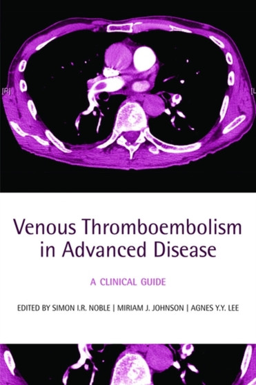 Venous Thromboembolism in Advanced Disease : A clinical guide by Simon I R Noble - Paperback