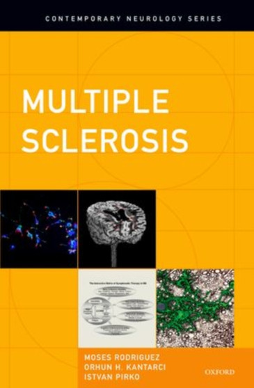 Multiple Sclerosis by Moses Rodriguez - Hardback