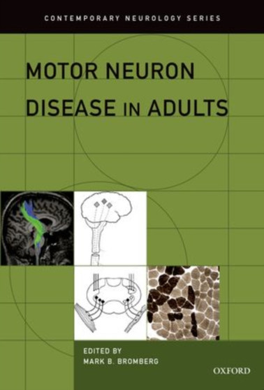 Motor Neuron Disease in Adults by Mark B. Bromberg - Hardback