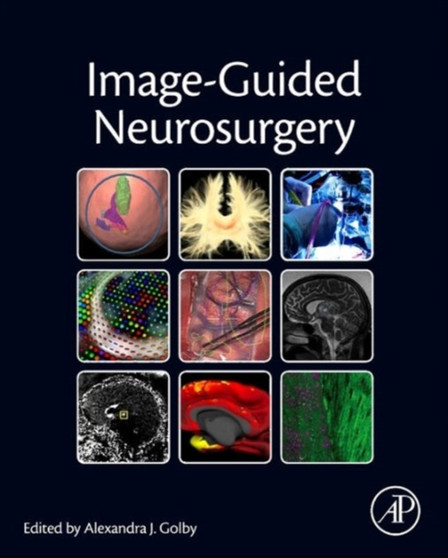 Image-Guided Neurosurgery by Alexandra J. Golby - Hardback