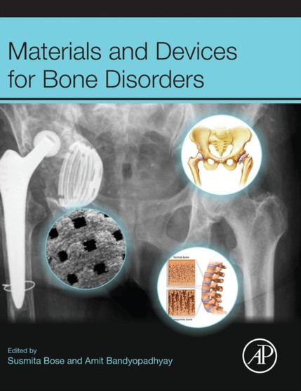 Materials and Devices for Bone Disorders by Susmita Bose - Hardback