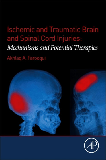 Ischemic and Traumatic Brain and Spinal Cord Injuries : Mechanisms and Potential Therapies by Akhlaq A. Farooqui - Paperback