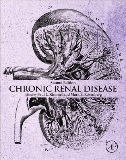 Chronic Renal Disease by Paul L. Kimmel - Hardback