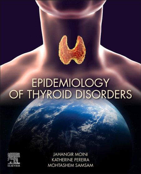 Epidemiology of Thyroid Disorders by Jahangir MD MPH Moini - Paperback