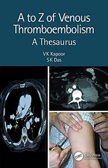 A to Z of Venous Thromboembolism : A Thesaurus by VK Kapoor - Hardback
