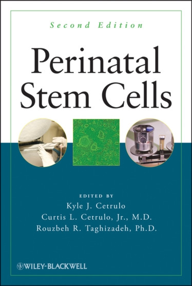 Perinatal Stem Cells by Kyle Cetrulo - Hardback