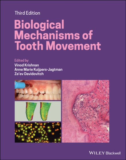 Biological Mechanisms of Tooth Movement by Vinod Krishnan - Hardback
