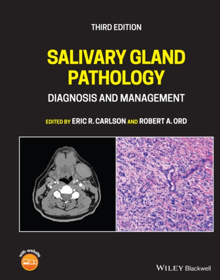 Salivary Gland Pathology : Diagnosis and Management by Eric R. Carlson - Hardback