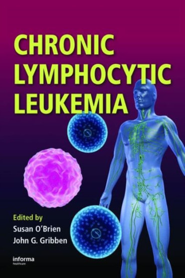 Chronic Lymphocytic Leukemia by Susan O'Brien - Hardback