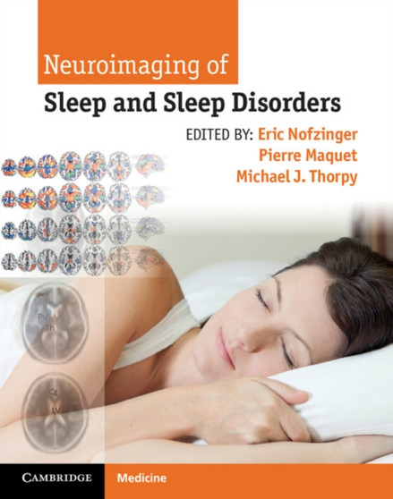 Neuroimaging of Sleep and Sleep Disorders by Eric Nofzinger - Hardback