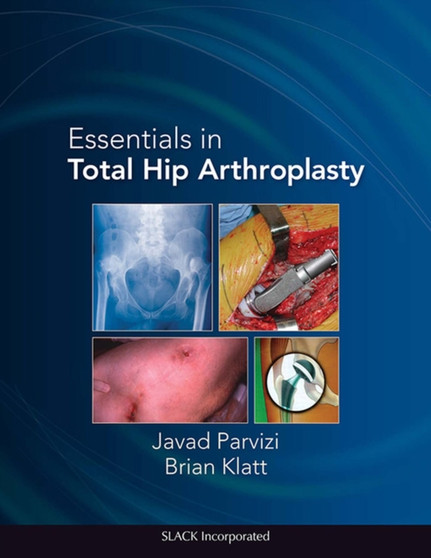 Essentials in Total Hip Arthroplasty by Javad Parvizi - Hardback