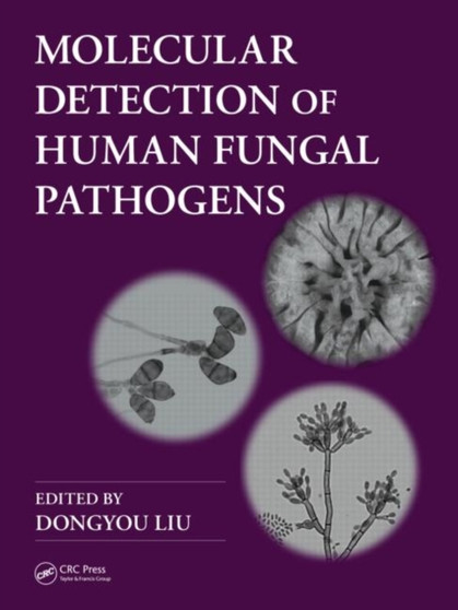 Molecular Detection of Human Fungal Pathogens by Dongyou Liu - Hardback