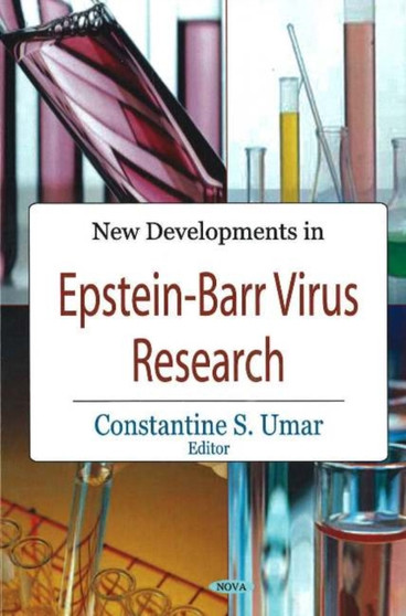 New Developments in Epstein-Barr Virus Research by Constantine S Umar - Hardback