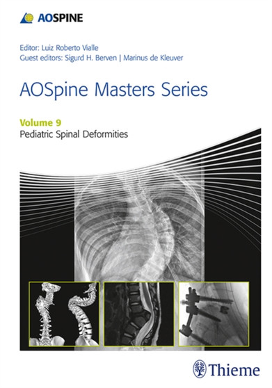 AOSpine Masters Series, Volume 9: Pediatric Spinal Deformities by Sigurd Berven - Hardback