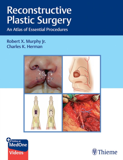 Reconstructive Plastic Surgery : An Atlas of Essential Procedures by Robert Murphy - Hardback