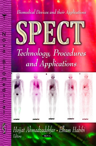 SPECT : Technology, Procedures & Applications by Hojjat Ahmadzadehfar - Hardback