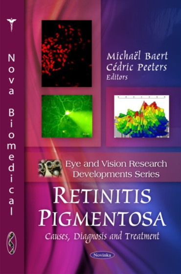 Retinitis Pigmentosa : Causes, Diagnosis & Treatment by Michael Baert - Paperback