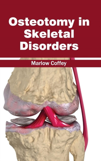 Osteotomy in Skeletal Disorders by Marlow Coffey - Hardback