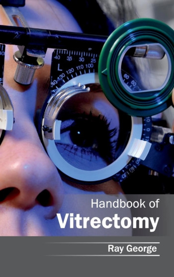 Handbook of Vitrectomy by Ray George - Hardback