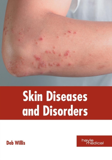 Skin Diseases and Disorders by Deb Willis - Hardback