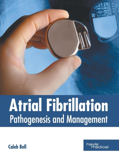 Atrial Fibrillation: Pathogenesis and Management by Caleb Bell - Hardback