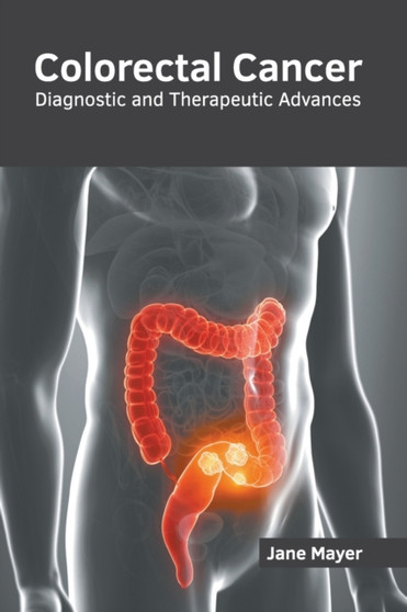 Colorectal Cancer: Diagnostic and Therapeutic Advances by Jane Mayer - Hardback